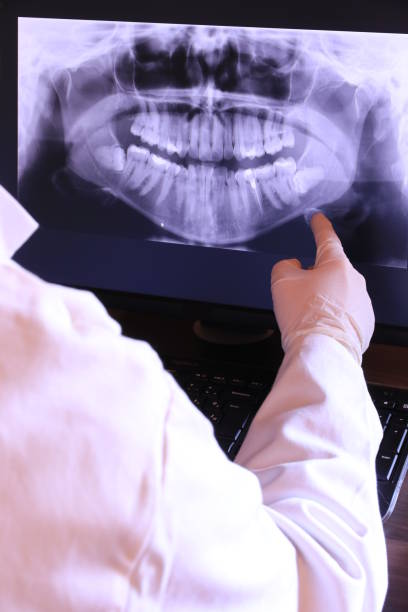 Best Emergency Dental Care for Broken or Chipped Teeth in North Hartsville, SC